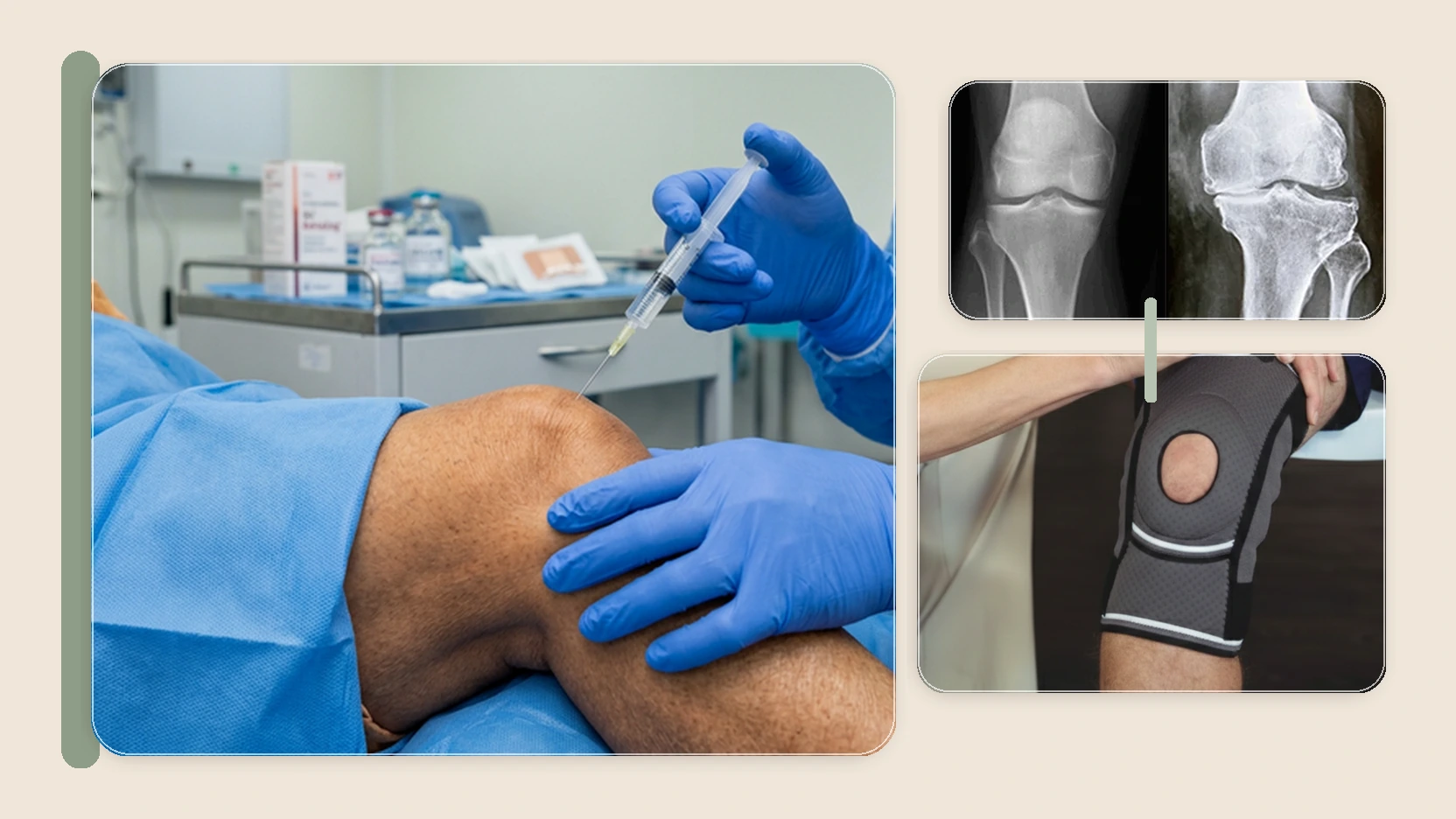 Knee Injections Not Helping Anymore? How Osteoarthritis Treatment Can Help in Kolkata